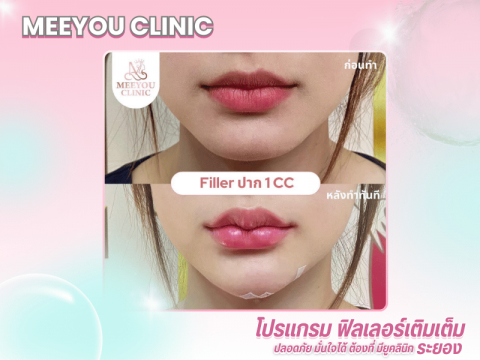 ปรับรูปหน้า ยกกระชับ เติมเต็มความอ่อนเยาว์ บริการ HIFU, โบท็อกซ์ และฟิลเลอร์